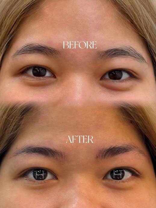 Before & After — eyebrow result by Shimmy