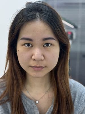 Healed Results — eyebrow result by Shimmy